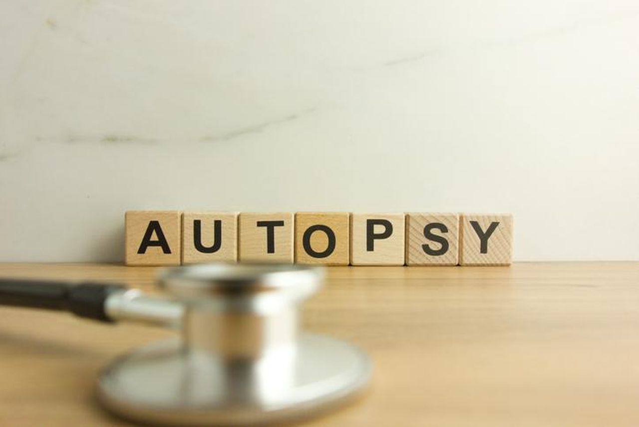 Autopsie_in_conflitto_sul_decesso_di_Richardson_tx9TKJlAQJ - Confidenze24 source:bossip - Autopsie in conflitto sul decesso di Richardson - Autopsia rappresentata con blocchi di legno e stetoscopio