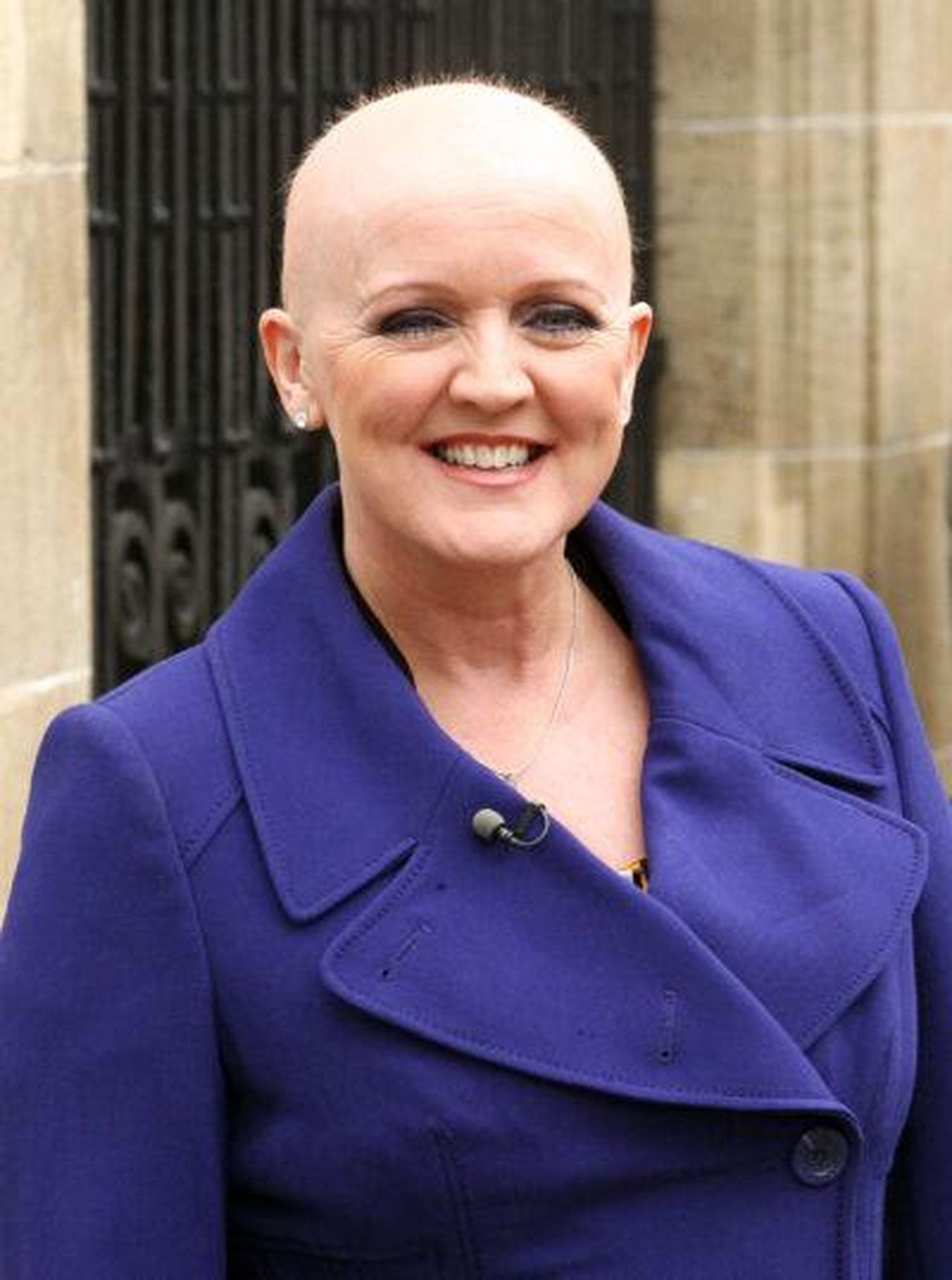 Bernie_Nolan__stata_diagnosticata_due_volte_RwJaydabiZ - Confidenze24 source:entertainmentdaily - Bernie Nolan è stata diagnosticata due volte - Bernie Nolan indossa un cappotto blu