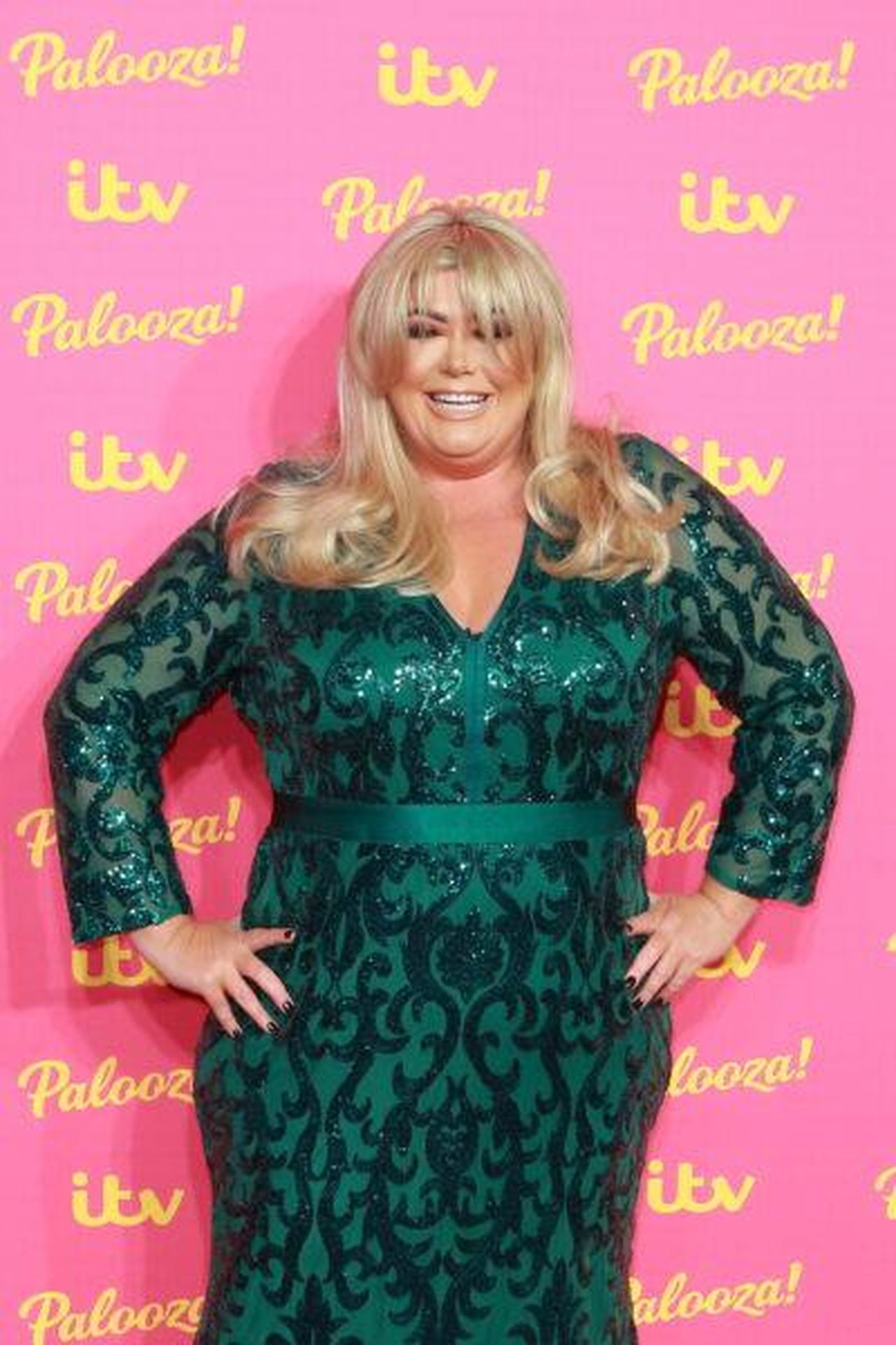 Gemma_Collins_ammette_di_usare_iniezioni_dimagranti_5V0UfshNd2 - Confidenze24 source:entertainmentdaily - Gemma Collins ammette di usare iniezioni dimagranti - Gemma Collins in posa