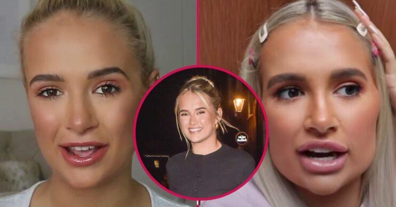 Le_foto_di_MollyMae_prima_e_dopo_7yvNKlQpdU - Confidenze24 source:entertainmentdaily - Le foto di Molly-Mae prima e dopo - Immagini di Molly-Mae che mostrano il prima e dopo dei filler cosmetici
