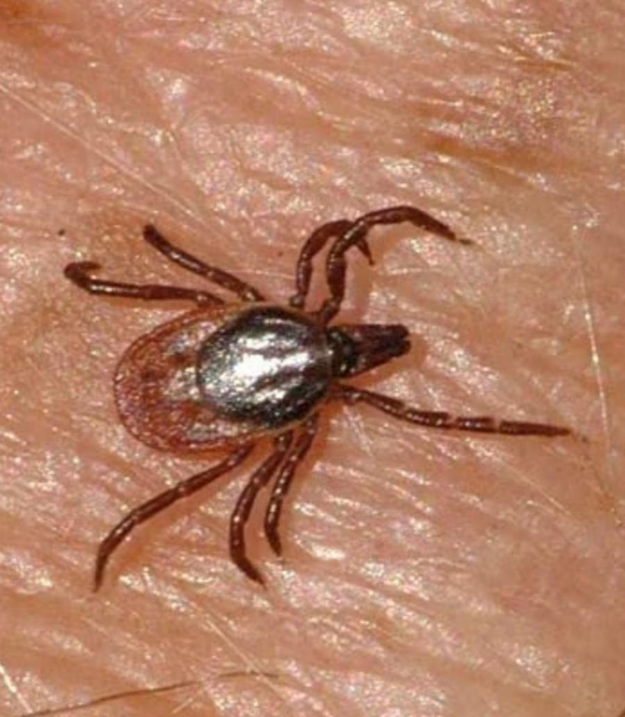 Scoperto_un_nuovo_virus_causa_sintomi_di_malattia_febbrile_26_casi_accertati_lbgQ4u4xUM - Confidenze24 source:tvzap - Scoperto un nuovo virus, causa sintomi di malattia febbrile: 26 casi accertati - Immagine del nuovo virus in Cina
