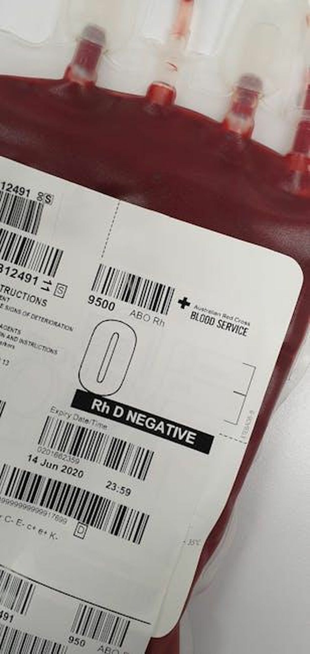 Adelaide_sta_sempre_pi_male_e_sembra_sparita_nel_nulla_56t6bMG5Oo - Confidenze24 Source: Charlie-Helen Robinson - pexels - Detailed view of a blood bag labeled Rh D Negative for medical donation purposes.