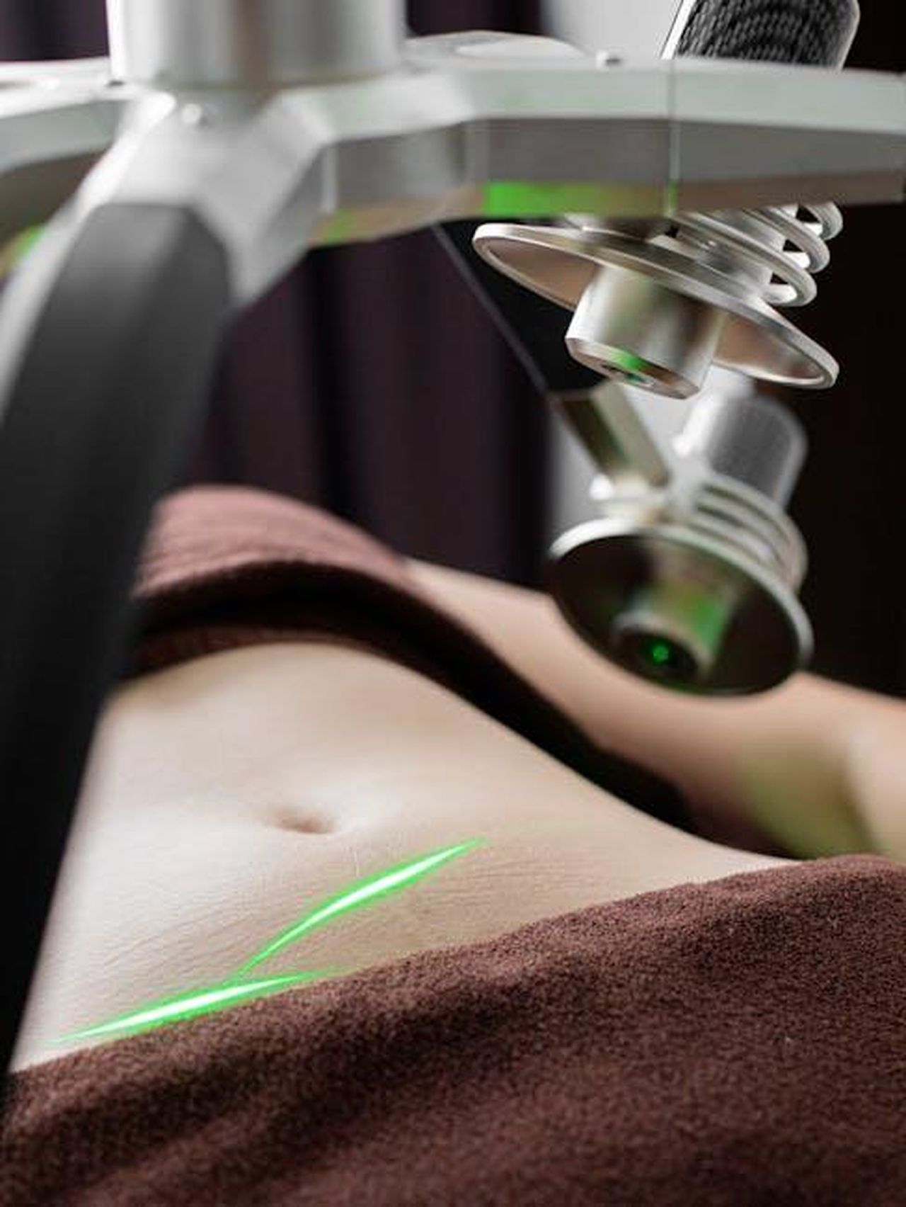 Critica_dellindustria_del_benessere_in_The_White_Lotus_HOGT84rSW0 - Confidenze24 Source: Dmitriy Ganin - pexels - Close-up of a laser device used in non-invasive body contouring treatment on a woman's abdomen.