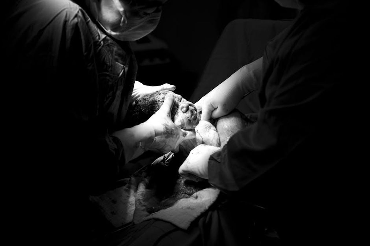 Il_miracolo_e_la_verit_svelata_TZXvUHvQ4F - Confidenze24 Source: izzet çakallı - pexels - Black and white photo capturing a newborn's first moments in a surgical setting.