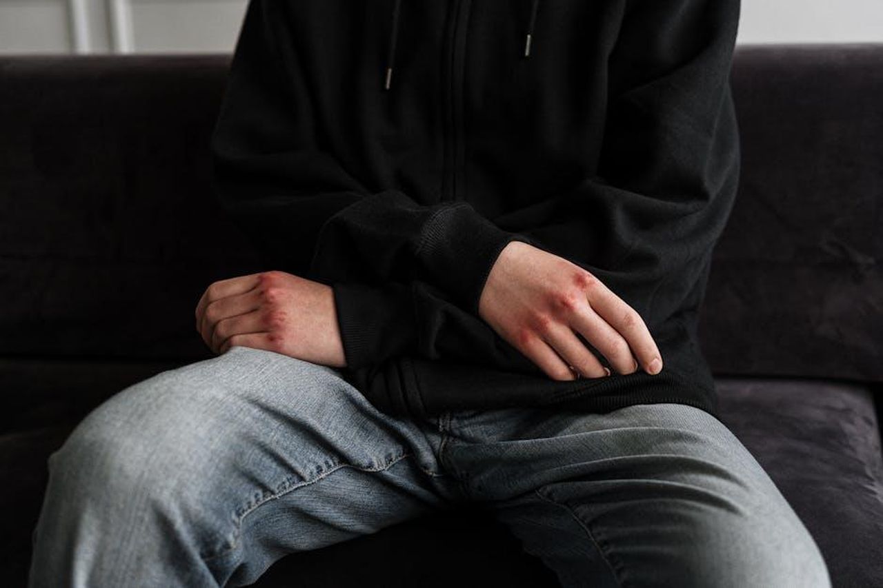 Le_dichiarazioni_inquietanti_di_Giglio_k5C5xia7h3 - Confidenze24 Source: cottonbro studio - pexels - A close-up of a teenager with bruised hands, wearing a hoodie and jeans, sitting on a couch.