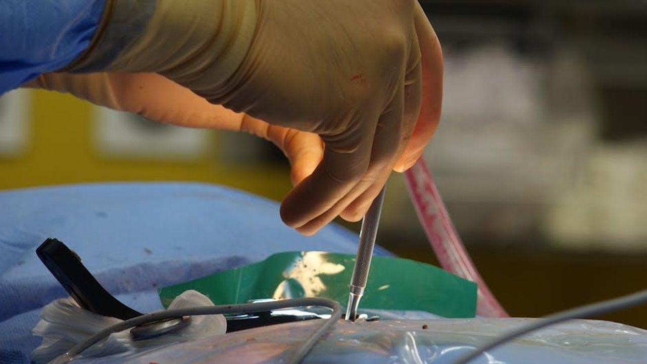 Maria_De_Filippi_interviene_per_Tina_Xyt8DE0orf - Confidenze24 Source: Viktors Duks - pexels - Spine Surgery