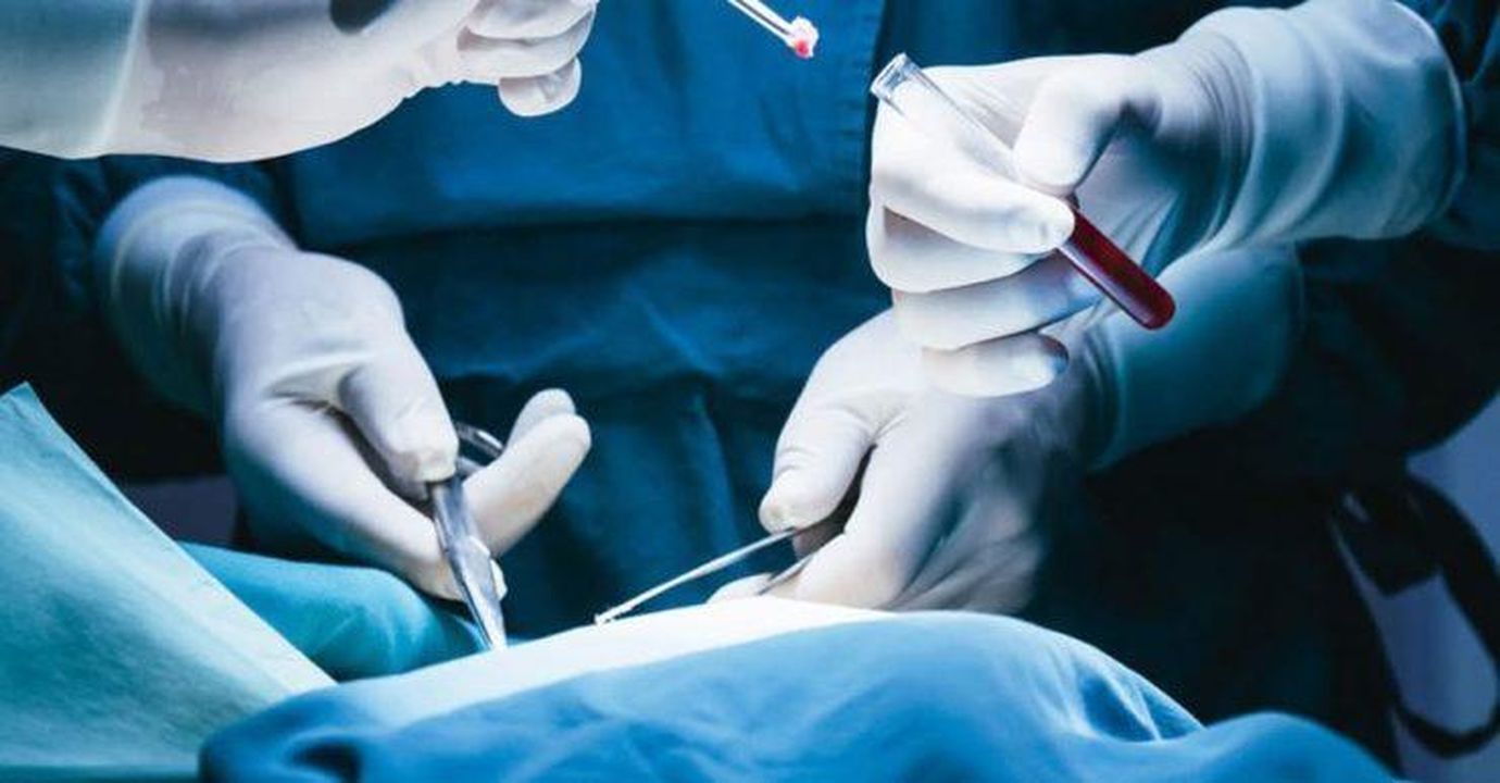Scopri_il_caso_straordinario_di_un_chirurgo_che_ha_contratto_il_cancro_da_un_paziente_durante_un_intervento_le_sorprendenti_scoperte_del_team_medico_RLO2g5jBrr - Confidenze24 Scopri il caso straordinario di un chirurgo che ha contratto il cancro da un paziente durante un intervento: le sorprendenti scoperte del team medico. - Immagine del caso straordinario