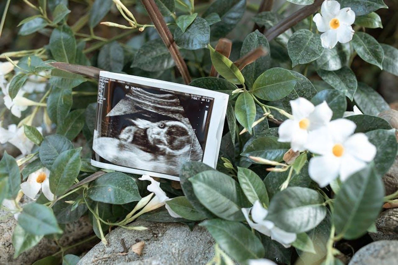 Annuncio_della_gravidanza_e_del_nuovo_bambino_rQj1qnA4Oa - Confidenze24 Source: RDNE Stock project - pexels - An ultrasound print nestled among green leaves and white flowers, symbolizing new beginnings.
