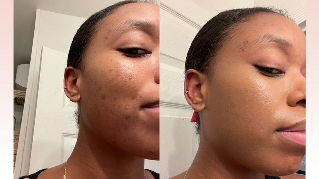 Applicazione_semplice_e_senza_disordine_KAAk1u4QOB - Confidenze24 Applicazione semplice e senza disordine Applicazione del Beauty Balm Serum Boosted Skin Tint