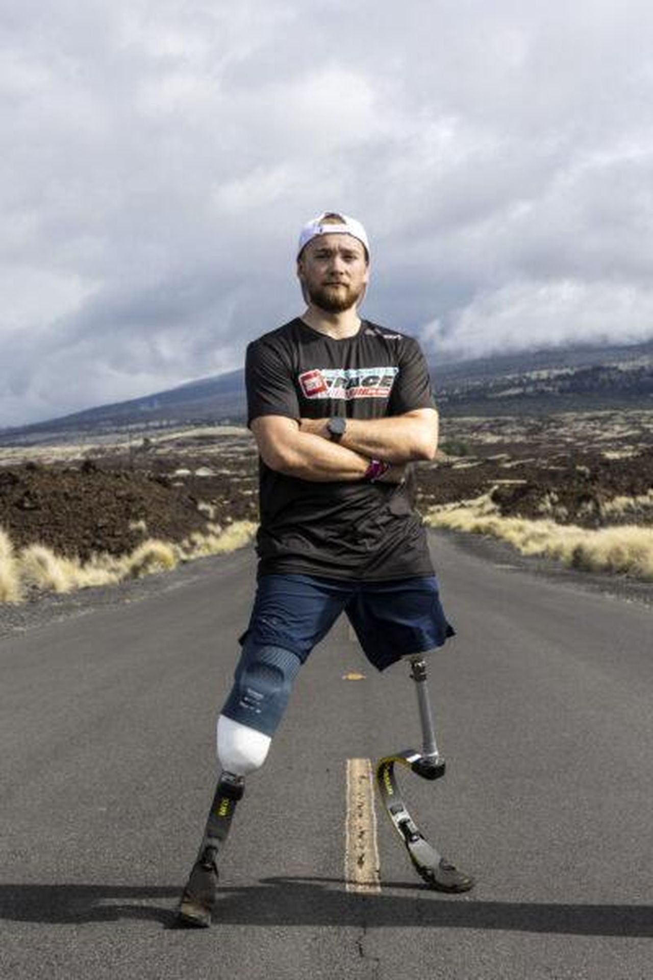 Come_Billy_Monger_ha_perso_le_gambe_zrs9GSCK9f - Confidenze24 Source: BBC - - Billy Monger durante la sua sfida per Comic Relief