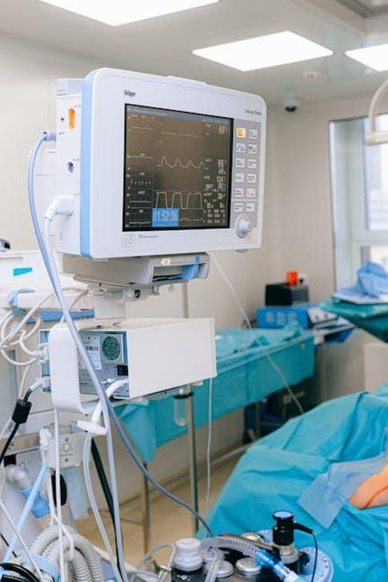 Coronation_Street_spoilers_DeeDee_rushed_into_surgery_as_she_gives_birth_K3ORThzjP7 - Confidenze24 Source: Anna Shvets - pexels - Close-up of vital signs monitor in a modern operating room setup.
