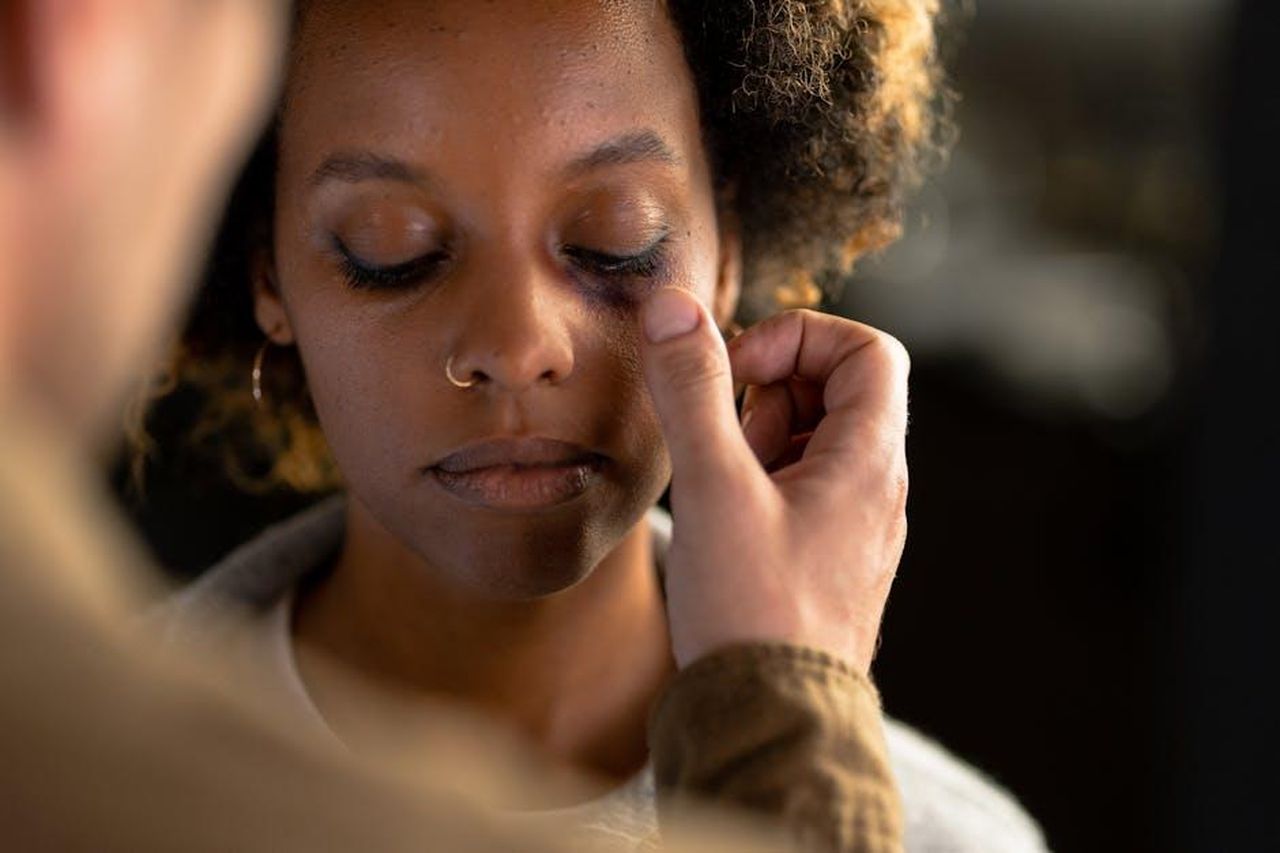 Difesa_di_Alison_Hammond_da_parte_dei_fan_McBclIa1eS - Confidenze24 Source: cottonbro studio - pexels - A person gently touches a woman's face with a visible bruise under her eye, showing concern.