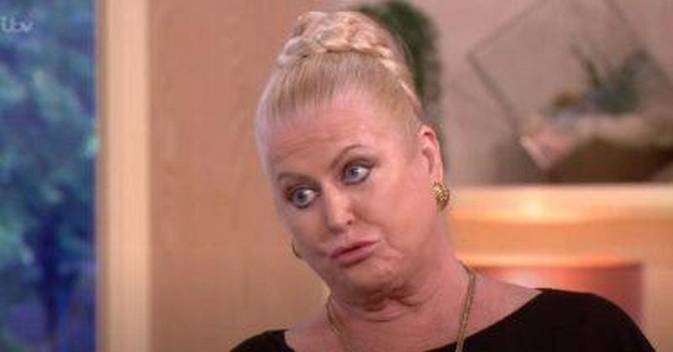 I_fan_inviano_messaggi_di_supporto_a_Kim_7rqP4b2XEI - Confidenze24 Source: ITV - - Kim Woodburn su This Morning