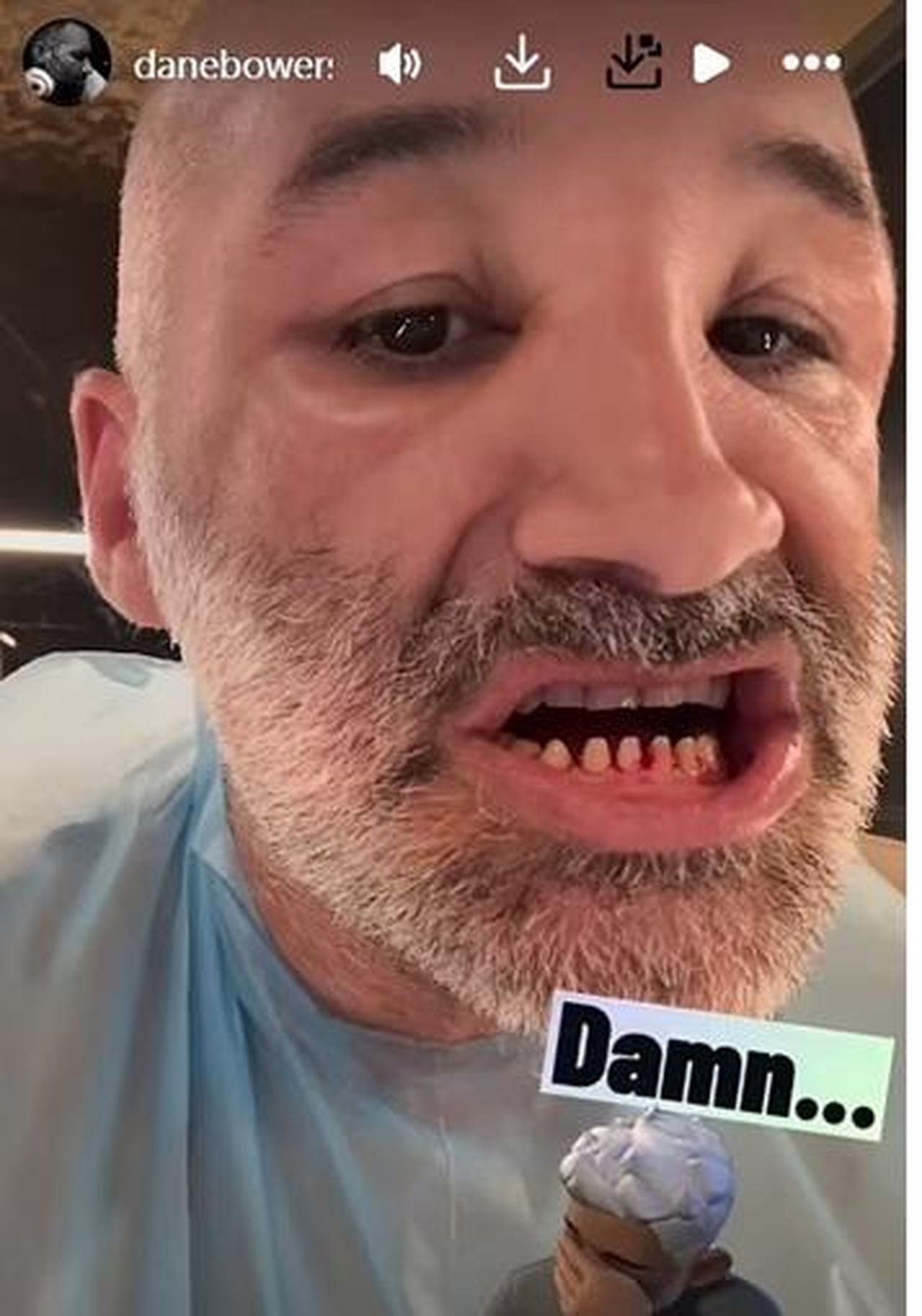 Il_nuovo_look_di_Dane_Bowers_dopo_lintervento_3Y503sCUtk - Confidenze24 Source: Instagram - - Dane Bowers mostra i denti su Instagram Story