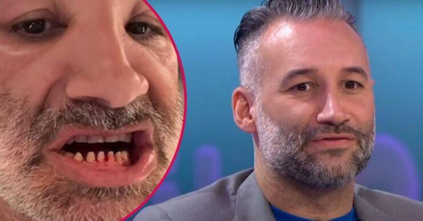 Il_nuovo_look_di_Dane_Bowers_dopo_lintervento_KdQbUcUjHo - Confidenze24 Il nuovo look di Dane Bowers dopo l'intervento Dane Bowers mostra i denti