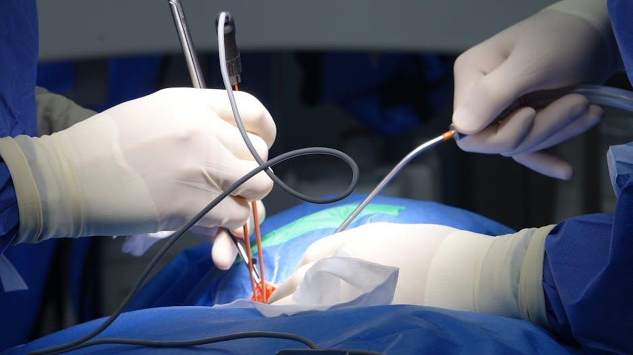 Il_recupero_e_la_reazione_della_famiglia_kVLIoA9Cvw - Confidenze24 Source: Viktors Duks - pexels - Surgeons performing a delicate medical operation with precision tools and gloves.