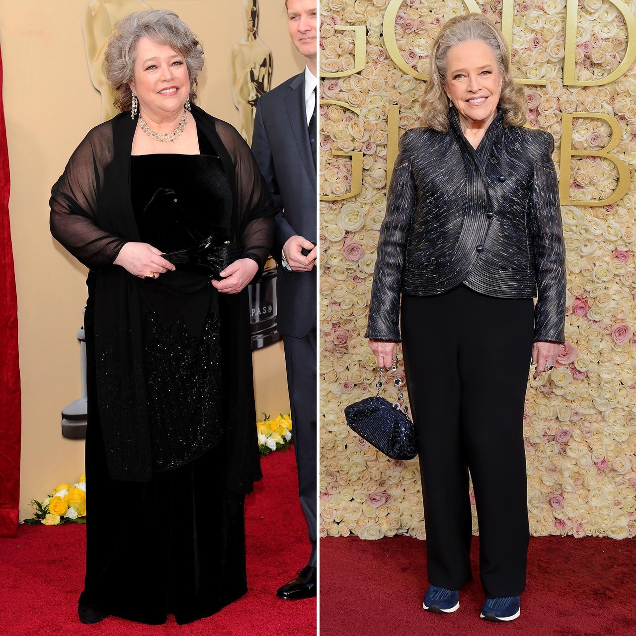 Il_viaggio_di_Kathy_Bates_verso_la_salute_9KndGY7Es7 - Confidenze24 Source: Getty Images - - Kathy Bates dopo la perdita di peso