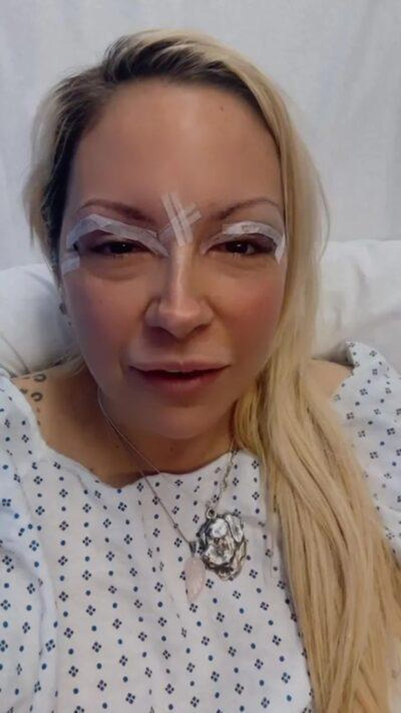 Jodie_ha_mostrato_il_suo_nuovo_intervento_di_chirurgia_estetica_qyhFSe0ex9 - Confidenze24 Jodie ha mostrato il suo nuovo intervento di chirurgia estetica Jodie Marsh dopo l'intervento di chirurgia estetica
