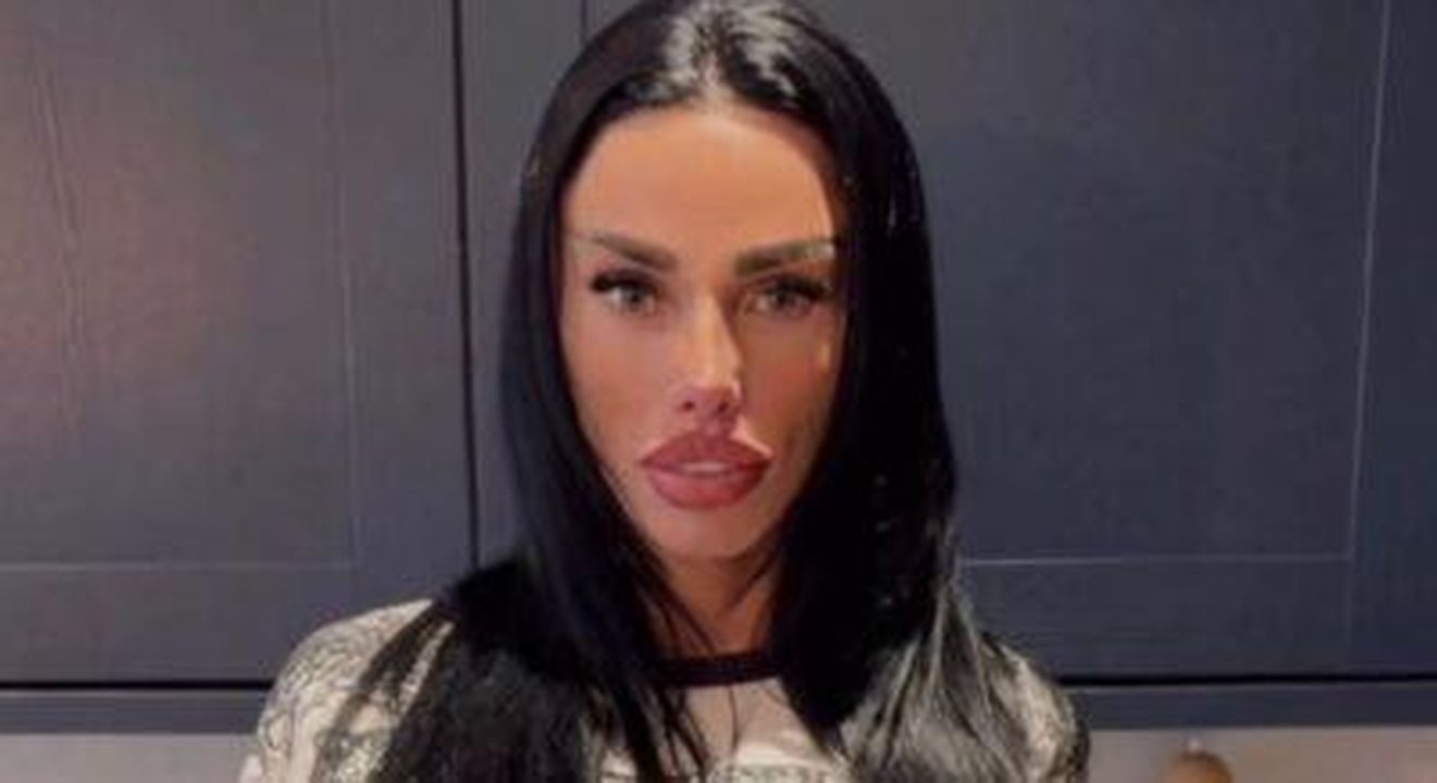 Katie_Price_mostra_i_risultati_dellultimo_intervento_chirurgico_B7Zg3Jhh0f - Confidenze24 Source: Facebook - Facebook - Katie Price in posa