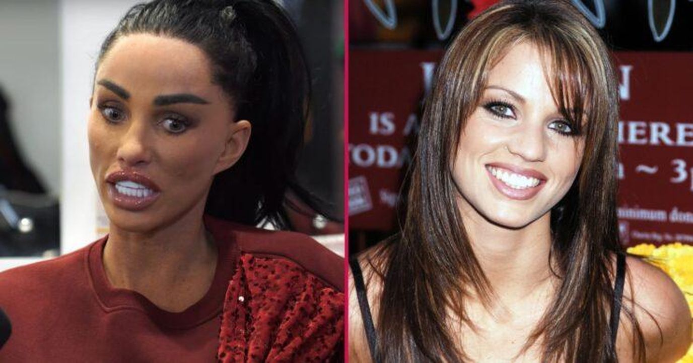 Katie_Price_suscita_preoccupazione_con_i_nuovi_denti_FlcxMDQ3oM - Confidenze24 Katie Price suscita preoccupazione con i nuovi denti Katie Price prima e dopo