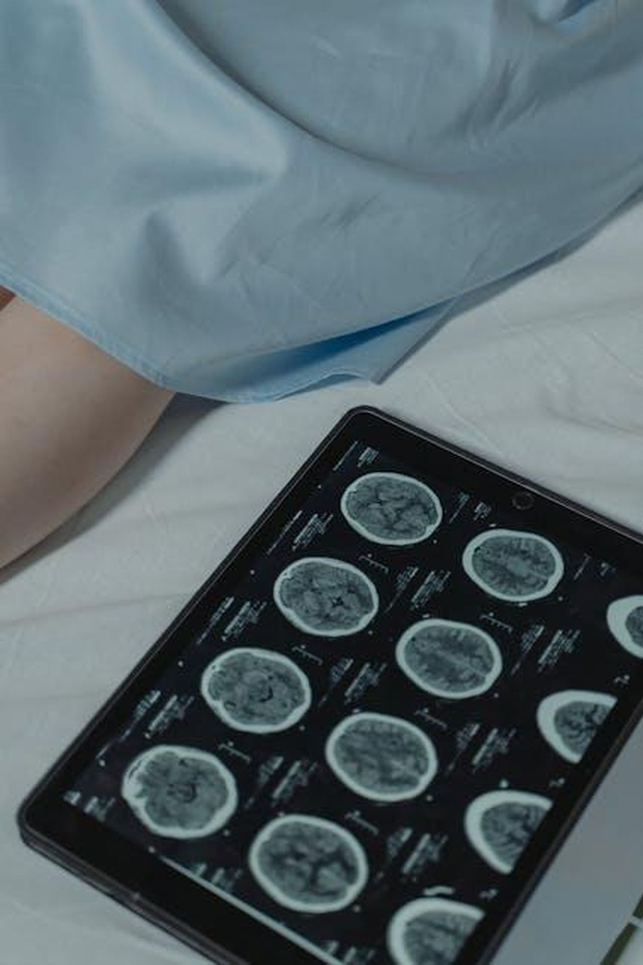 La_sua_normalit_dopo_lintervento__estenuante_khESnNgnxi - Confidenze24 Source: Tima Miroshnichenko - pexels - Close-up of a digital tablet showing brain scans next to patient in a hospital setting.