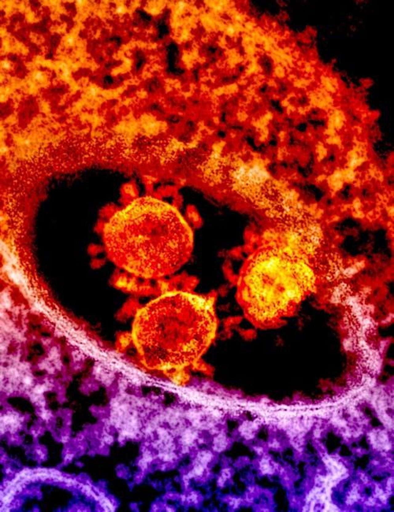 Le_teorie_di_Kennedy_sulla_salute_e_i_vaccini_Y1SYEhxjfJ - Confidenze24 Source: CDC - pexels - Colorful microscopic image depicting coronavirus particles in vibrant detail.