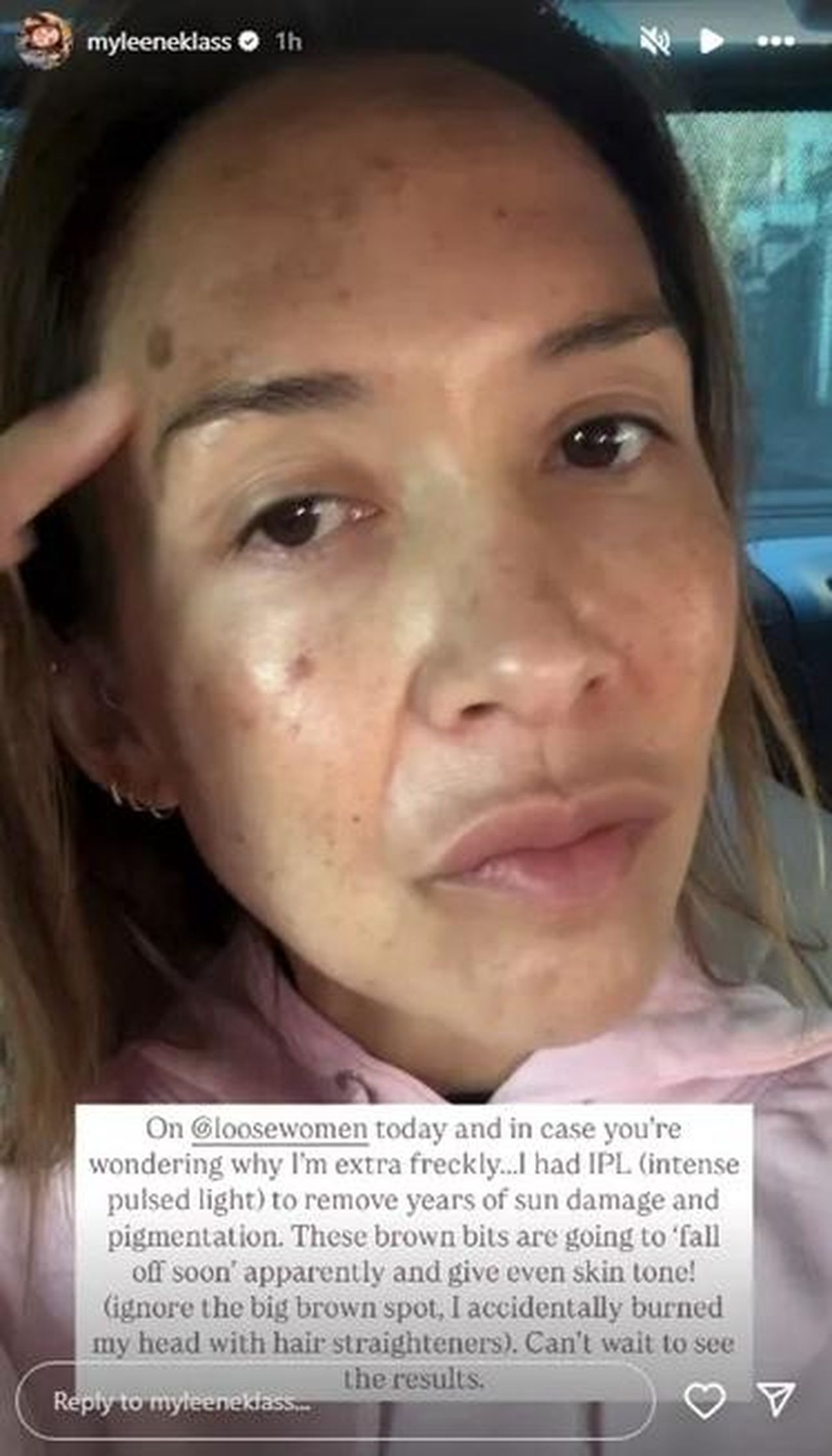 Myleene_Klass_parla_del_suo_aspetto_a_Loose_Women_JmCGcJQaMh - Confidenze24 Source: Instagram - - Myleene Klass Instagram Story