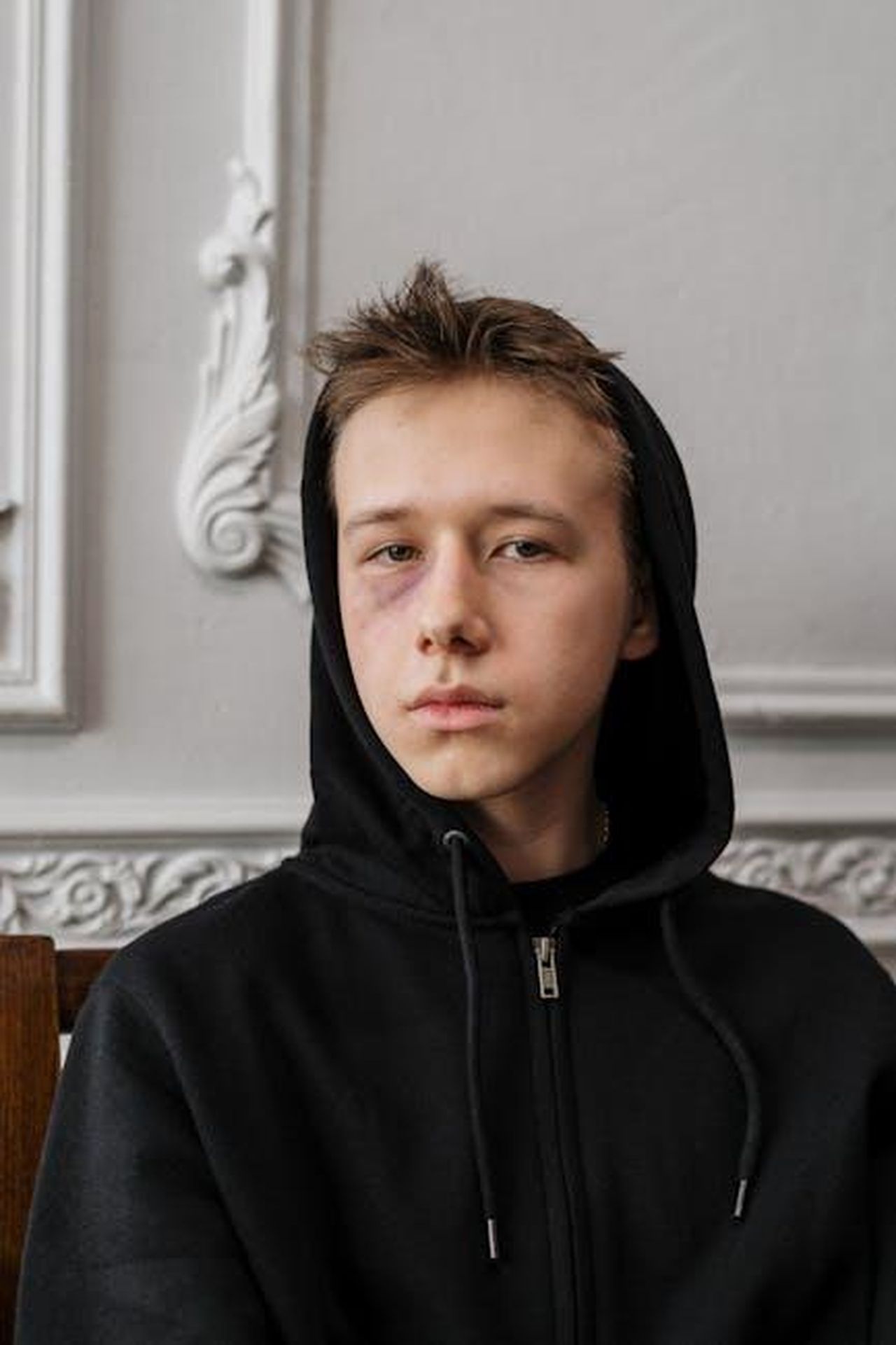 Quellatteggiamento_per_K3RxWihY9R - Confidenze24 Source: cottonbro studio - pexels - Moody portrait of a teenage boy with a black hoodie and subtle bruise, indoors.