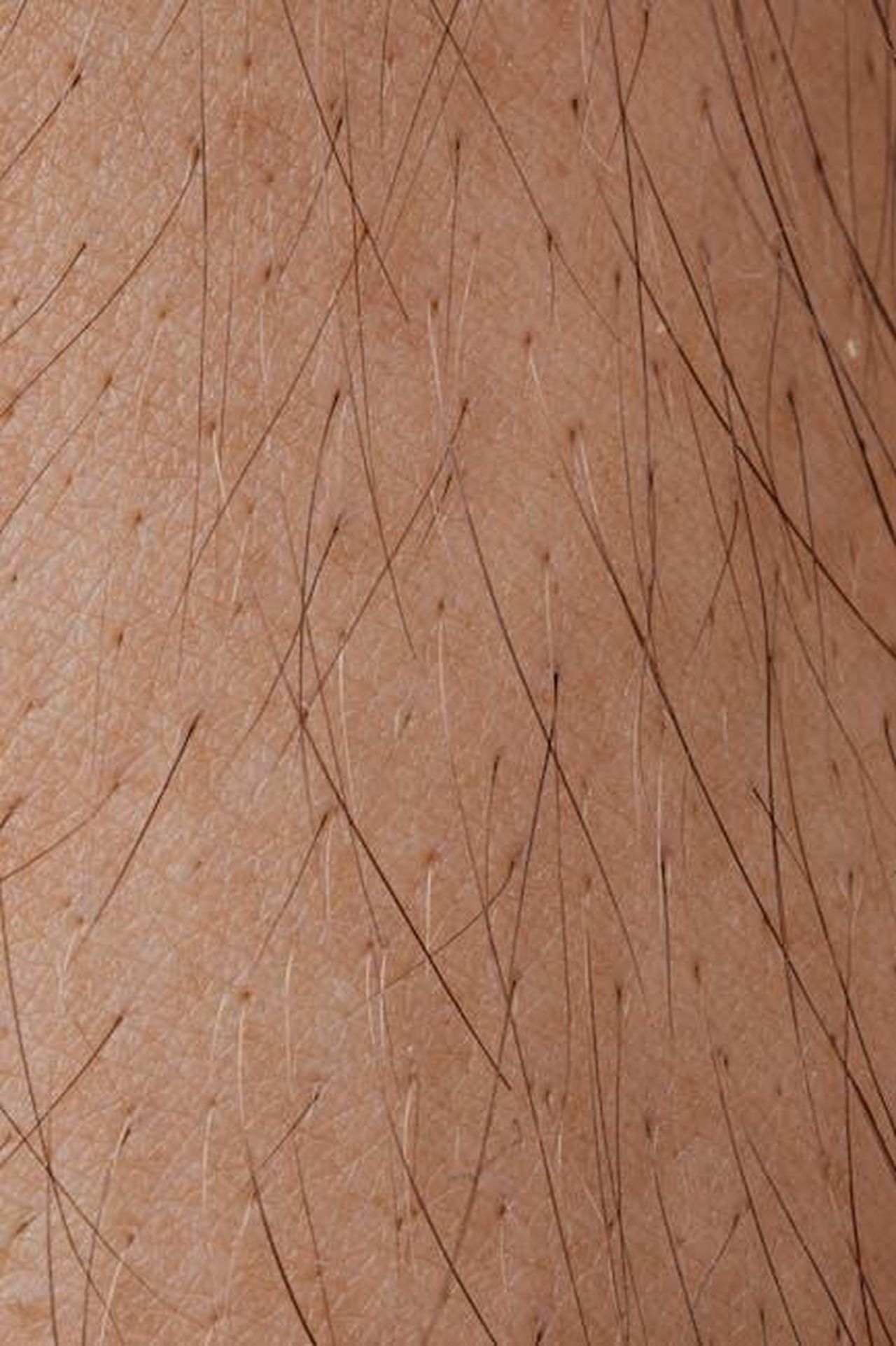 Risultati_e_recensioni_degli_utenti_fKXZek9UlA - Confidenze24 Source: Photo By: Kaboompics.com - pexels - Detailed macro image showing human skin texture and hair follicles.